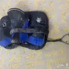 سرج خيل مع جميع اعراضه