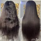 معالجات للشعر