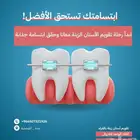 تقويم أسنان