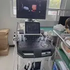 جهاز سونار بشري 4D Ultrasound machine for human