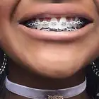 تقويم أسنان زينه