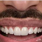 ابتسامه هوليود