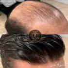 باروكة شعر طبيعي رجالي