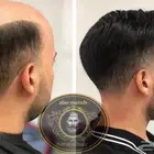 باروكة شعر(طبيعي)رجالي
