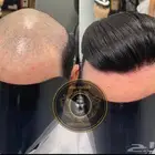 باروكة شعر (طببعي)رجالي