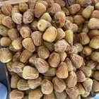 سكري القصيم