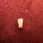 ضرس الماسي