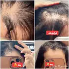 اعشاب هنديه لتكثيف وتطويل الشعر عن تجربه