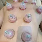 متخصص حجامة منزلية خبرة اكثر من 5 سنوات