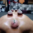 متخصص حجامة منزلية خبرة اكثر من 5 سنوات