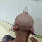 متخصص حجامة منزلية خبرة اكثر من 5 سنوات في الحجامة الشرعية