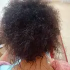 متخصصه علاجيه للشعر ومشاكل التساقط والصلع والهيشان