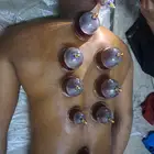 اخصائي حجامه منزليه