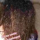 جلسات الهيرو بيبى بالاعشاب حقيقى نقله مختلفه للجلسات العلاج