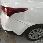 مركز بي6 شفط وتعديل الصدمات