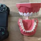 نموذج أسنان