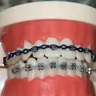 تقويم اسنان زينه