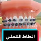تقويم اسنان زينه