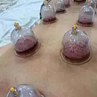متخصص حجامة منزلية خبرة اكثر من 5 أعوام