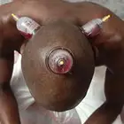 متخصص حجامة منزلية خبرة اكثر من 5 سنوات