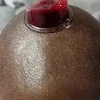 متخصص حجامة منزلية خبرة اكثر من 5 سنوات