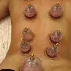 متخصص حجامة خبرة اكثر من 5 سنوات