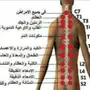 حجامة السنة النبوية بالطائف 