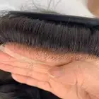 باروكه و شبكيه فرنسيه
