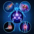 تدريس طب جراحة عظام