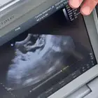 كشف الحمل للأغنام والماعز بالسونار