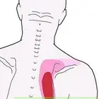 معاك الأبهر أو تعرف أحد عنده ابهر علاج طبيعي وانسى اللألم