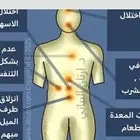 شلعة السرة