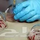 متخصص حجامة