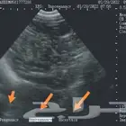 عمل سونار للاغنام والماعز