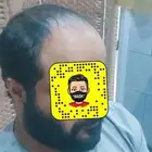 باروكه تركيب شعر طبيعي للرجل