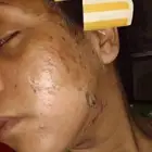 مقشر وجه وجسم.