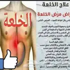 علاج الخلعه وحجامه
