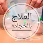 العلاج بالحجامة