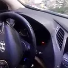 تنجيد قشره طبلون ازيرا
