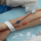 مطلوب متبرع بكليه الفزعه تكفون عمره 14 سنه. اي منطقه جاهز