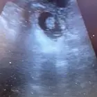 فحص سونار غنم