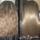 جلسه علاجيه بالفيلر والكافيار والكولاجين