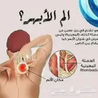 متخصص حجامة