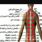 الحجامة وفوائدها