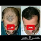 ماذا تنتظر استعد م فقد منك ف اسرع وقت