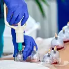 الحجامة سر النقاء والصحة من السنة النبوية