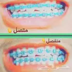 تقويم اسنان زينه السعر 125 الطقم لمده محدوده