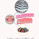 تقويم أسنان يا بلاشش   