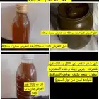 الحصمه