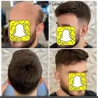 تركيب شعر طبيعي لصق اصلي